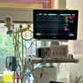 Il monitor della Terapia intensiva di Udine con i parametri vitali dell’uomo salvato dall’infarto