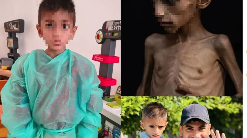 Il piccolo Osama, curato all'ospedale di Verona
