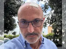 Fabio Carini con il capo fasciato dopo essere stato colpito da un bastone caduto dal terzo piano