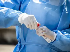 25/08/2020 Milano, Test sierologici e tamponi drive in all‚ÄôOspedale San Paolo; nella foto un operatore sanitario esegue il tampone per il Covid-19