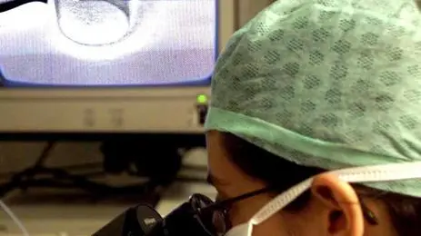 BIOETICA: DOPO RU486, TUTTE LE BATTAGLIE PRO-VITA. Una immagine di archivio, datata 6 giugno 2006, di una inseminazione svolta in laboratorio. Congelare gli ovuli ed effettuare o meno la diagnosi pre-impianto sono al centro del dibattito sulla procreazione assistita: sull'impianto della legge 40, dopo il ricorso di una coppia di talassemici, si e' espressa anche la Corte Costituzionale, eliminando il limite massimo di tre embrioni da impiantare e introducendo la possibilita' di crioconservare gli ovuli. La legge proibisce anche la ricerca sulle staminali embrionali, che e' portata avanti in Italia utilizzando quelle in circolazione all'estero. CIRO FUSCO / ARCHIVIO / ANSA / LI