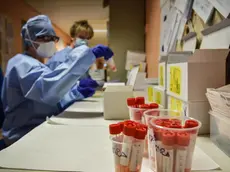 Personale sanitario del laboratorio di microbiologia dellÂ?ospedale di Cremona effettuano prelievi ematici per i test sierologici per verificare la presenza degli anticorpi per lÂ?emergenza epidemia coronavirus Covid-19. ANSA/MATTEO CORNER