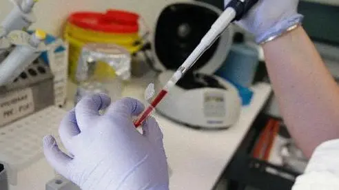 Esami clinici in un laboratorio analisi ANSA