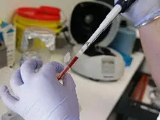 Esami clinici in un laboratorio analisi ANSA