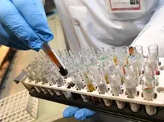 Provette nel laboratorio di analisi dell'ospedale S.Martino di Genova. 30 gennaio 2017 a Genova. ANSA/LUCA ZENNARO