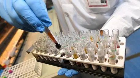 Provette nel laboratorio di analisi dell'ospedale S.Martino di Genova. 30 gennaio 2017 a Genova. ANSA/LUCA ZENNARO