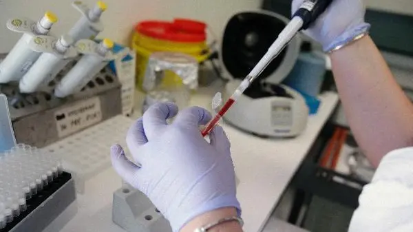 Esami clinici in un laboratorio analisi ANSA