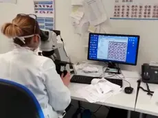 E' 'blindato' da venerd?? 21 febbraio, quando ?? esploso il contagio da Coronavirus, ma ?? pienamente operativo anche oggi l'ospedale di Schiavonia (Padova). Dentro vi sono 150 pazienti, in quarantena ma nessuno positivo al virus, e 150-200 tra medici e infermieri, che possono uscire e rientrare per i turni, facendo ogni volta il tampone. "Sul nastro trasportatore le provette si susseguono una dopo l'altra, fermandosi per pochi attimi nelle 'stazioni' di processo, dove un sistema automatizzato provvede con azioni robotiche a centrifugarle, stapparle, prelevare il campione da analizzare, inviarle alla stazione successiva, per poi chiuderle e riporle in un frigorifero" scrive in un post su Fb il direttore dell'Ulss 6 Euganea, Domenico Scibetta, elogiando gli 'angeli' con il camice..ANSA/US ULSS