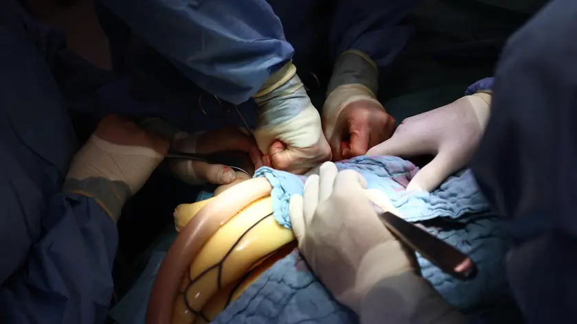 epa11223698 Surgeons perform a Left kidney operation at the German hospital unit with US soldiers, during the NATO exercise Allied Spirit 24 in Hohenfels, Germany, 16 March 2024. The US Army, along with NATO Allies and partners hosts Allied Spirit 24 from 26 February to 27 March 2024, with 7th Army Training Command at Hohenfels Training Area and Grafenwoehr Training Area, in Germany. Allied Spirit 24 is a recurring exercise designed to prepare a multinational brigade in support of NATO deterrence initiatives. Approximately 6,500 participants from NATO Allied and partner nations will participate in the exercise. Countries expected to participate in the exercise include, but are not limited to: Croatia, Denmark, Germany, Hungary, Italy, Lithuania, Netherlands, Spain, United States, and United Kingdom. EPA/ANNA SZILAGYI