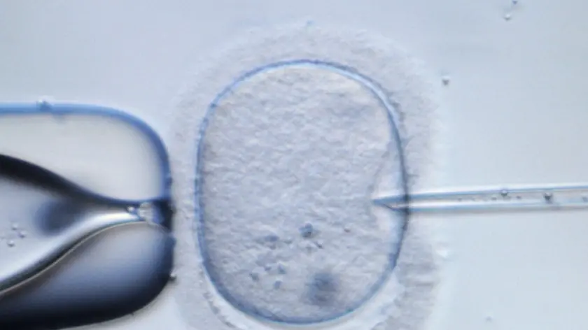 epa02373394 (FILE) - A file picture dated 09 February 2009 shows a human egg cell being injected for demonstration purposes at a laboratory in?Dresden,?Germany. British researcher Robert Edwards, pioneer of in vitro fertilization, won this year?s Nobel Prize for Medicine, it was announced in Stockholm on 04 October 2010. Edwards? research has "made it possible to treat infertility, a medical condition afflicting a large proportion of humanity including more than 10 per cent of all couples worldwide," the Nobel Assembly said. EPA/RALF?HIRSCHBERGER