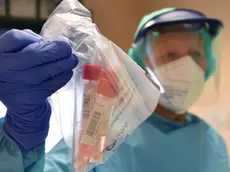 Coda delle persone rientrate dall’estero per fare il tampone all’ospedale Molinette, Torino, 23 agosto 2020 ANSA/ALESSANDRO DI MARCO