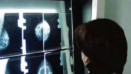Asfo affida i servizi di radiologia ai privati per cinque anni, rinnovabili per altri quattro, purché operino all’interno delle strutture ospedaliere pubbliche